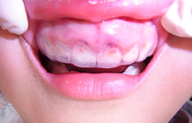 立川駅・近藤歯科医院